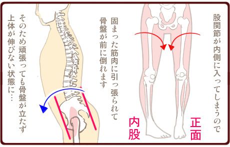 寝起きの腰痛は 反り腰 が原因だった 簡単に腰痛を治す方法もご紹介 Part 2